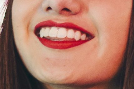 estética dental